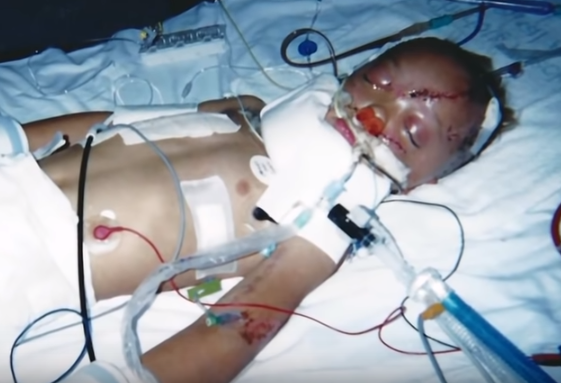 8-Year-Old Dies 3 Times Wakes Up and Tells About His Encounter With Jesus
