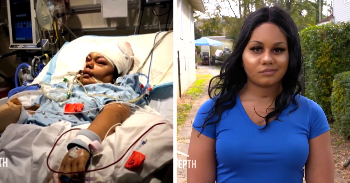 Young Mom Living With A Bullet In Brain Shares Her Miraculous Survival Story
