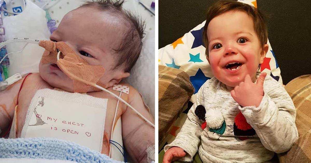 9-Month-Old Baby Miraculously Survives 25 Heart Attacks In 24 Hours, Leaving The Doctors Stunned