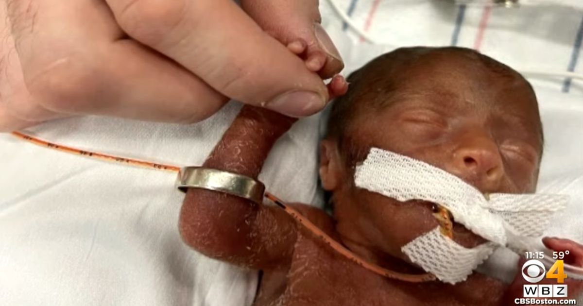 Baby Born At 22 Weeks Finally Goes Home After Spending More Than 6 Months In NICU