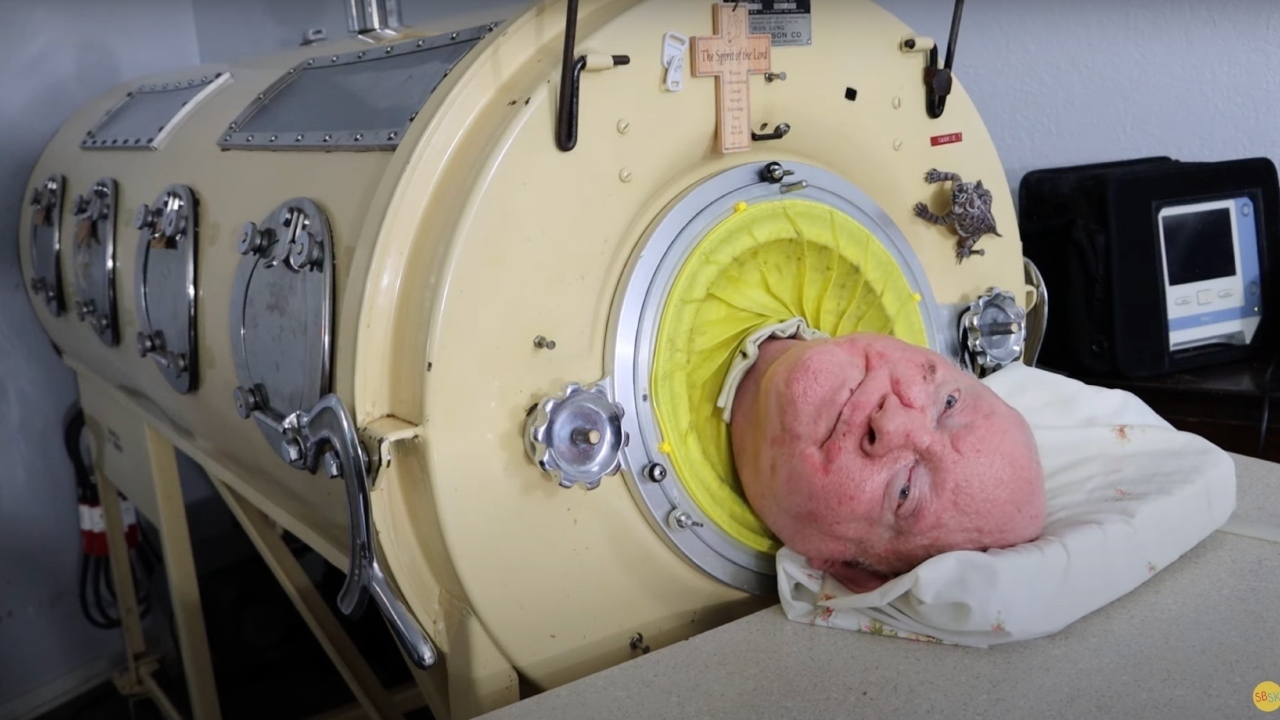 Paul Alexander, confined 72 years in iron lung, spoke of ‘God’s love’ before death